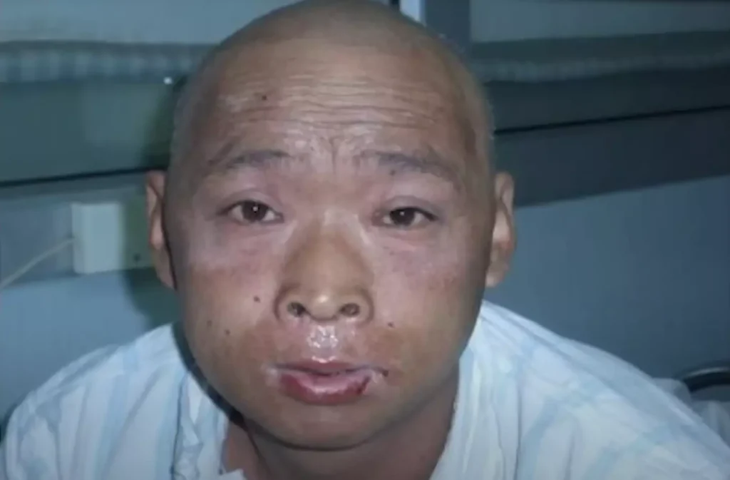 Who Was Hisashi Ouchi